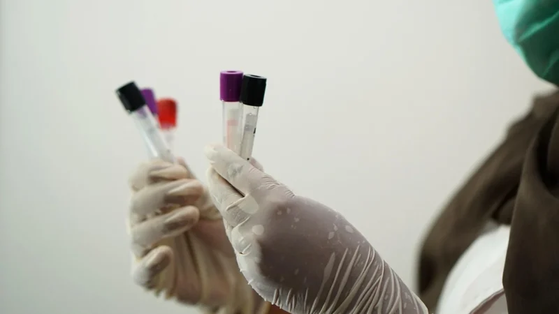 Badania laboratoryjne podstawowe: co mówią o zdrowiu i ryzyku chorób