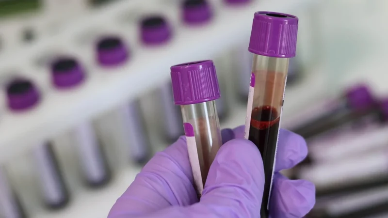 Jak przygotować się do badań laboratoryjnych, by wyniki wspierały leczenie