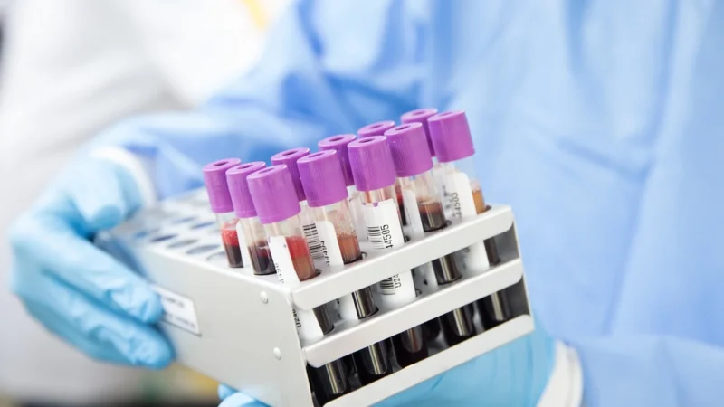 Podstawowe badania laboratoryjne: jak wykrywają choroby i wspierają leczenie