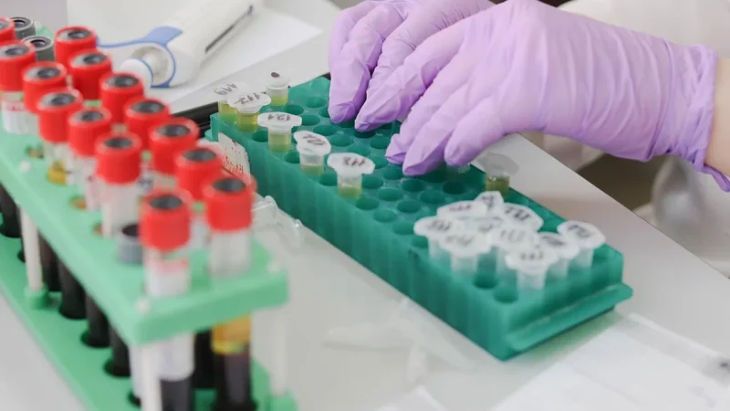 Profilaktyka zdrowotna w laboratorium: jak często badać krew i mocz