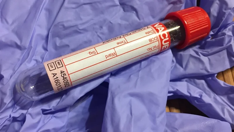 TSH, FT3, FT4: badania laboratoryjne tarczycy a leczenie i zdrowie